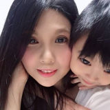 玻尿酸可以填補我的蘋果肌跟山根的部位嗎?